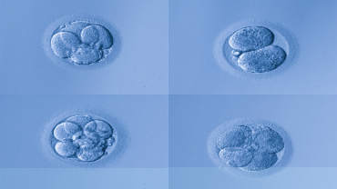 Embryo / Fœtus